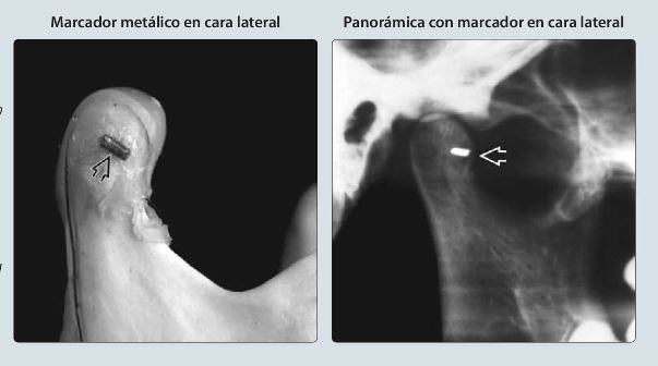 `alt` Imagenología estratégica en dolor orofacial Figura 1