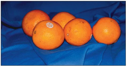 `alt`  Figura 5.1.Los cítricos, como las naranjas, son una fuente dietética rica en vitamina C.