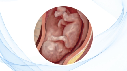 blog-perdida-gestacional-recurrente-por-malformaciones-uterinas-congenitas