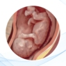 Causas Anatómicas de la Pérdida Gestacional Recurrente: Malformaciones Uterinas Congénitas
