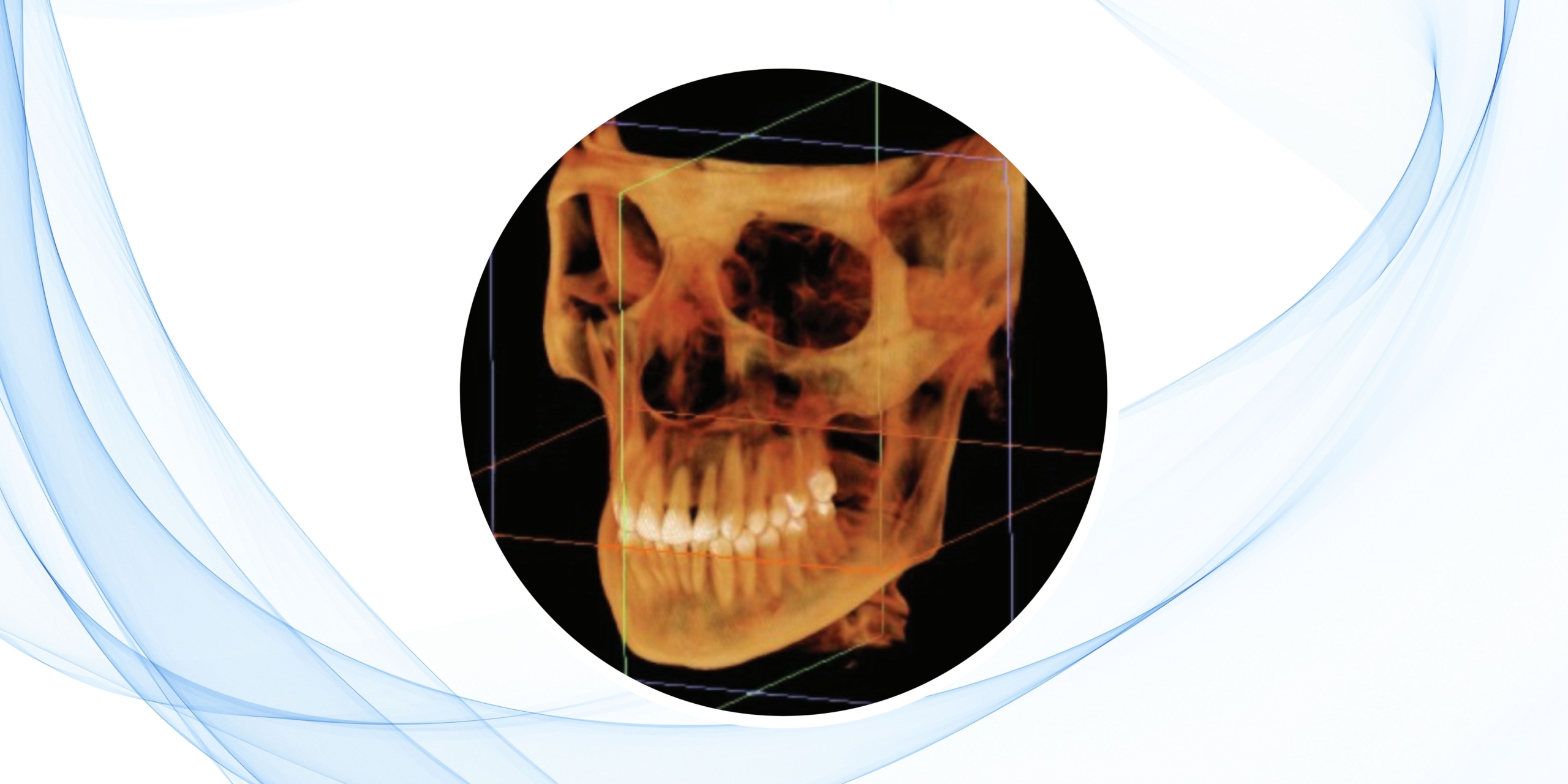 diagnostico-2D-vs-diagnostico-3D-en-ortodoncia