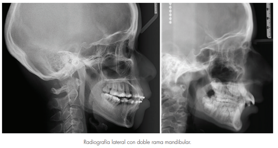 diagnostico-3d-en-ortodoncia