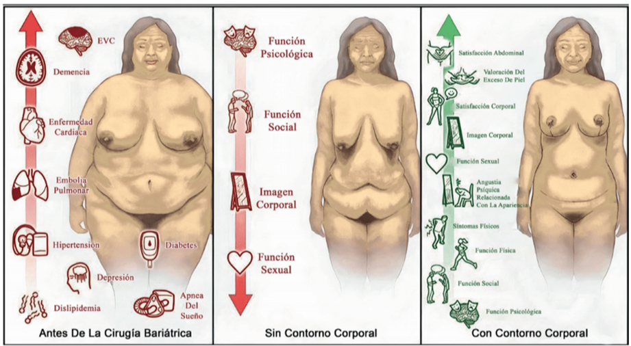 cirugia-bariatrica
