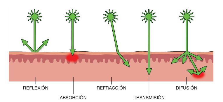 `alt` Complicaciones del láser transdérmico Figura 18.1