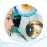 Casos clínicos pediátricos con OCT: guía para cirugía de catarata, glaucoma y anomalías del iris 