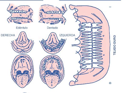 `alt` biopsia oral Figura 1.8. Plantilla de informe quirúrgico.