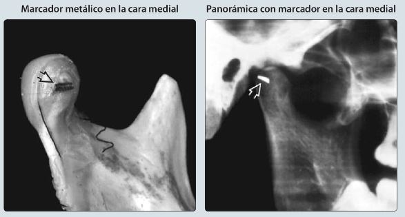 `alt` Imagenología estratégica en dolor orofacial Figura 2