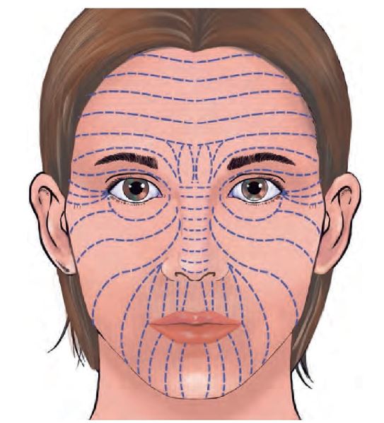 Figura 11.2. Orientación de las RSTL labiales. `alt` colgajos locales en labios y mentón 
