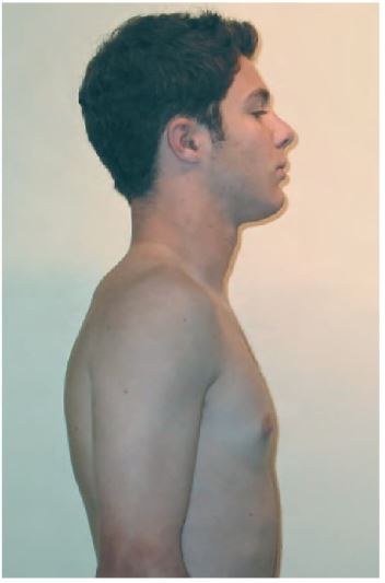 Figura 7.1.Posición neutra.