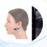 Aplicaciones de la ecografía facial en Dermatología y Cirugía Plástica