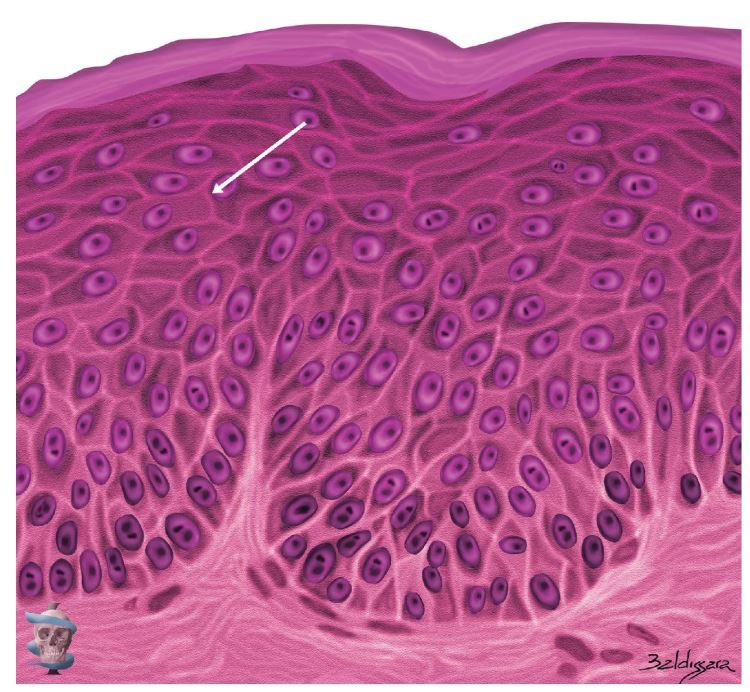 Figura 2.4.Ilustración de un corte histológico destacando los desmo-somas, que unen fuertemente las células de la capa espinosa, y así dan solidez a la epidermis. `alt` Anatomía facial