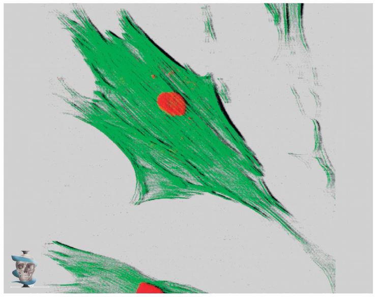 Figura 2.8. Fibroblasto dérmico humano bajo un microscopio confo-cal de barrido láser (reconstrucción 3D): Boggio, RF. Efeitos do bloquea-dor do canal de cálcio (verapamil) em fibroblastos dérmicos humanos. Tesis de Doctorado, Universidade de São Paulo, 2008