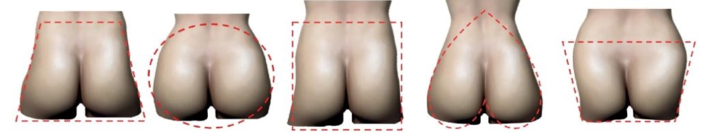 Figura 8.2. Glúteo en forma de A, glúteo redondo, glúteo cuadrado, glúteo en forma de corazón invertido, glúteo en forma de V. `alt` ácido poliláctico