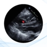 El papel clave de la imagen cardiovascular