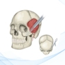 Cirugía endoscópica de fracturas faciales 
