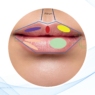 Análisis de la sonrisa para una voluminización labial armónica