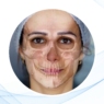 Face Gloss: rejuvenecimiento facial