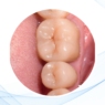 Biocerámicas para salvar sonrisas 